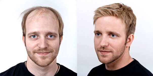 Männer mit glatze kennenlernen